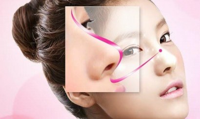 Phương pháp nâng mũi và độ bền của mỗi phương pháp